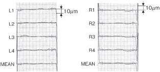 Lead chart (after processing 4000 pieces)
x500 x4 (JIS N4 equivalent)